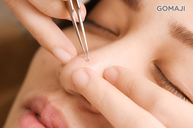 專業粉刺毛孔緊緻護理