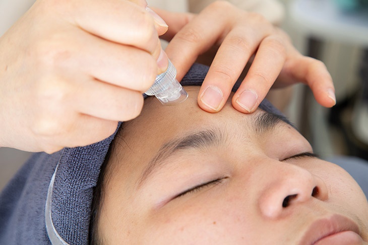 音波角質皮層淨透管理