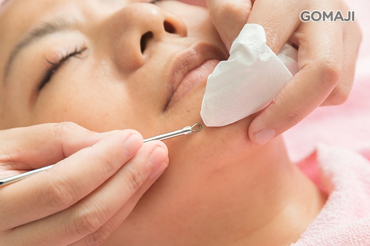 專業手工粉刺痘痘深層淨化