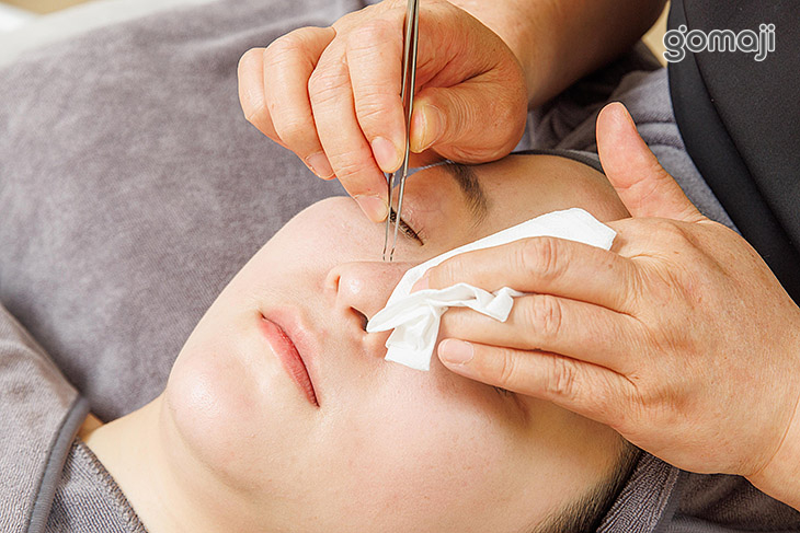 粉刺痘痘淨化調理