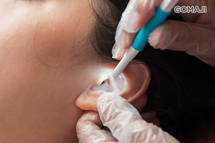 耳道內視鏡檢查