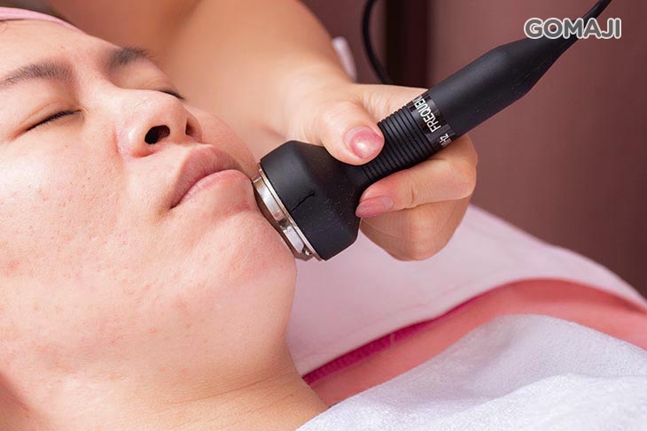 彈力精靈高濃縮超飽水膠原蛋白原液導入 