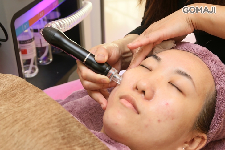 專業手工全臉深層粉刺淨化(含閉鎖性粉刺、內包性痘痘)