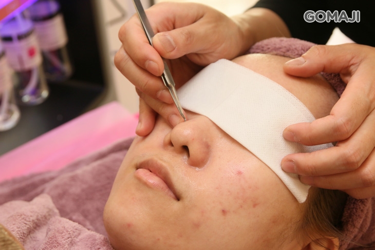 重點黑頭粉刺痘清潔(依個人膚況而定)