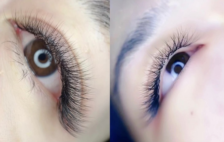 睫毛嫁接