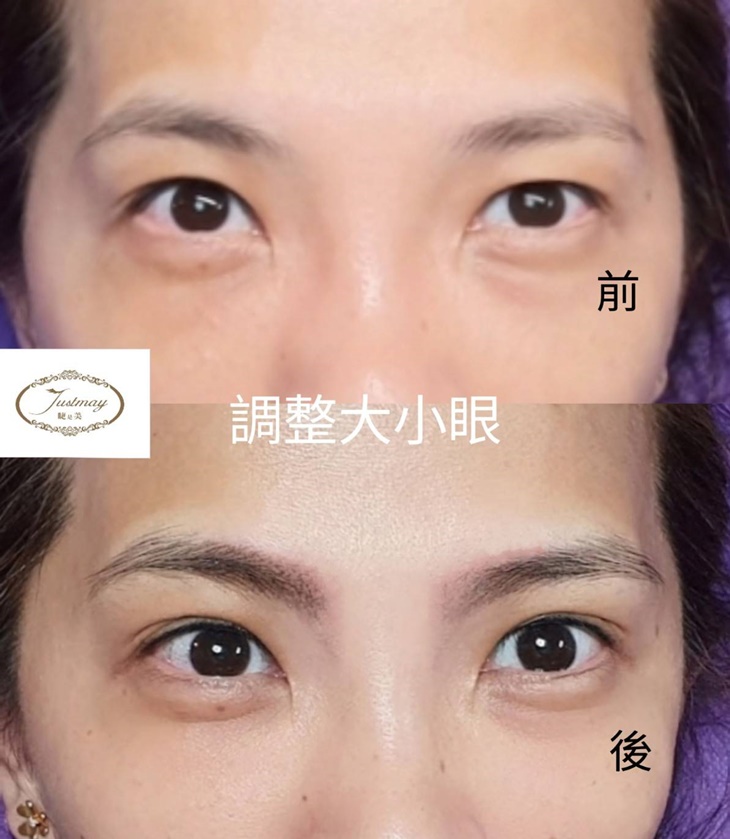 專業量身訂製-30年國家美容乙級專業資歷！調整大小眼精緻眼線