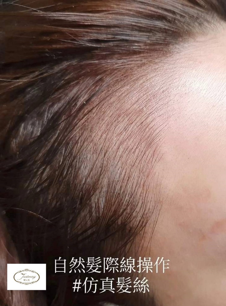 專業量身訂製-30年國家美容乙級專業資歷！仿真髮際線(分線明顯、落髮、高額救星)