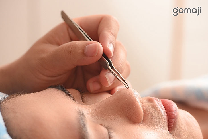 手工清除毛孔粉刺痘痘調理(依原生膚況客製化調整) 