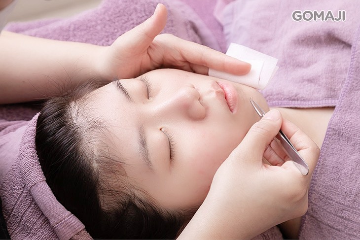 全臉痘痘粉刺淨化清除