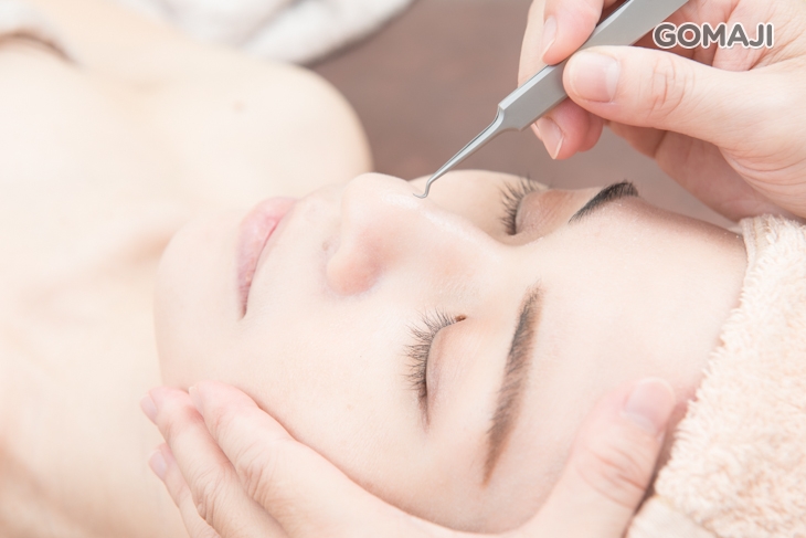 全臉柔敏粉刺清潔