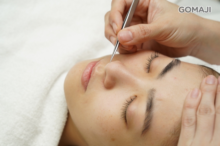 專業手工清粉刺