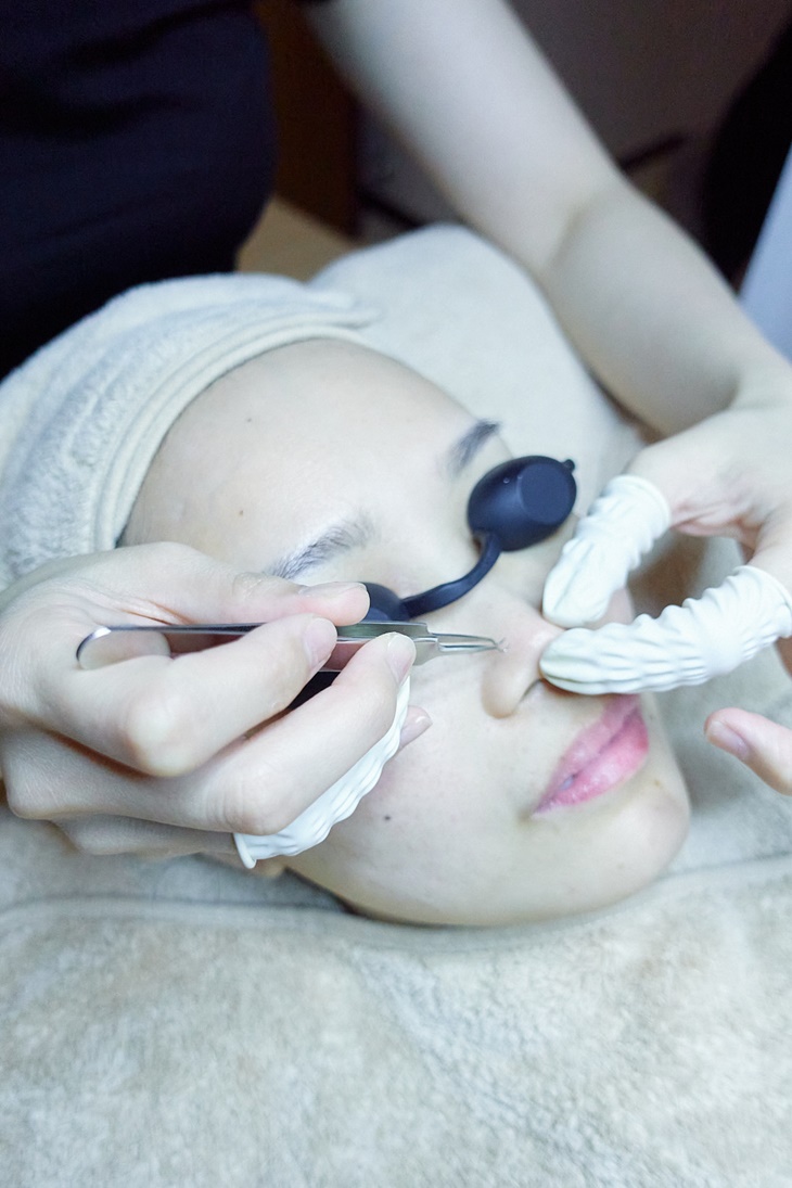 專業手工全臉清粉刺痘痘肉芽