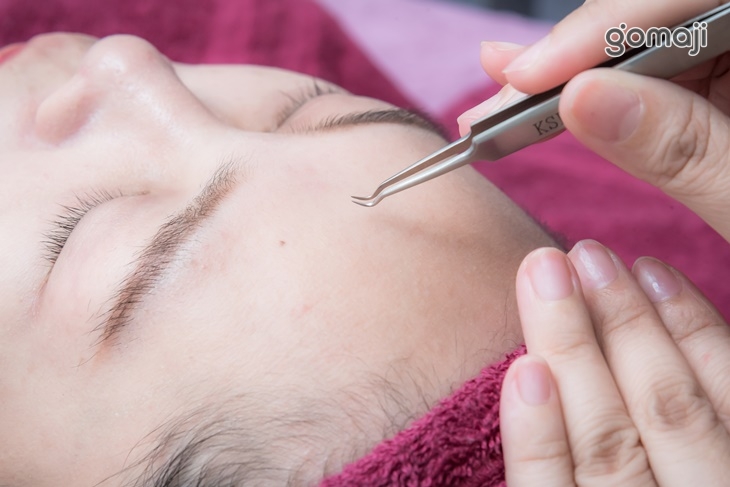 重點粉刺痘痘深層淨化調理