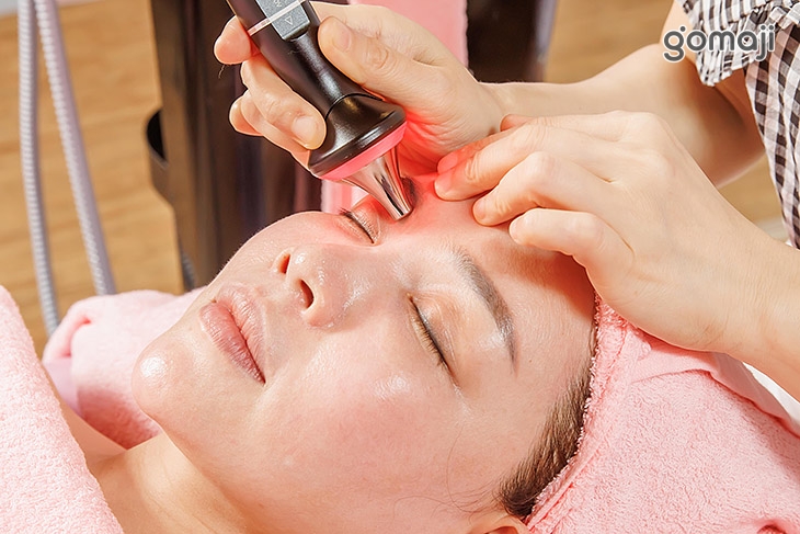 對抗魚尾紋！眼部聲波4RF射頻 