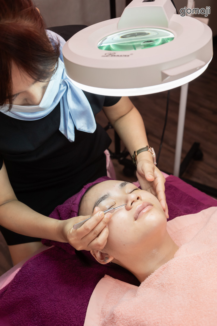 粉刺痘痘淨化調理