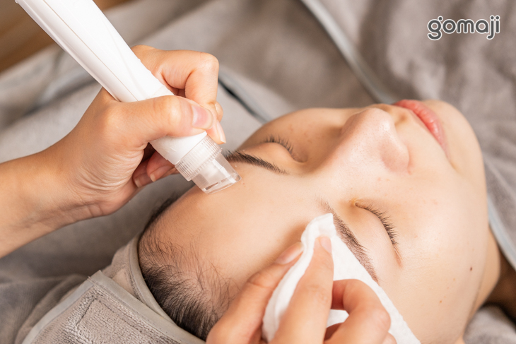 類醫美水飛梭清潔毛孔