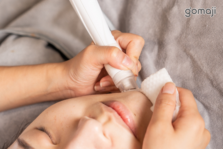 類醫美水飛梭清潔毛孔