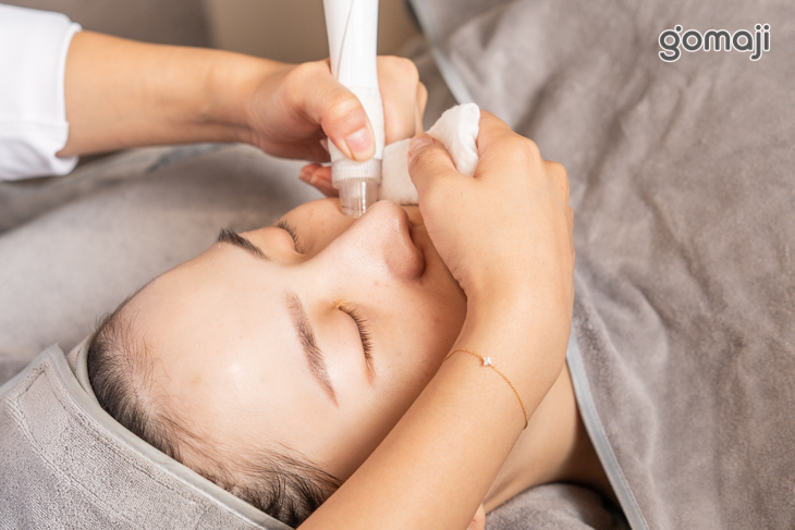 類醫美水飛梭清潔毛孔