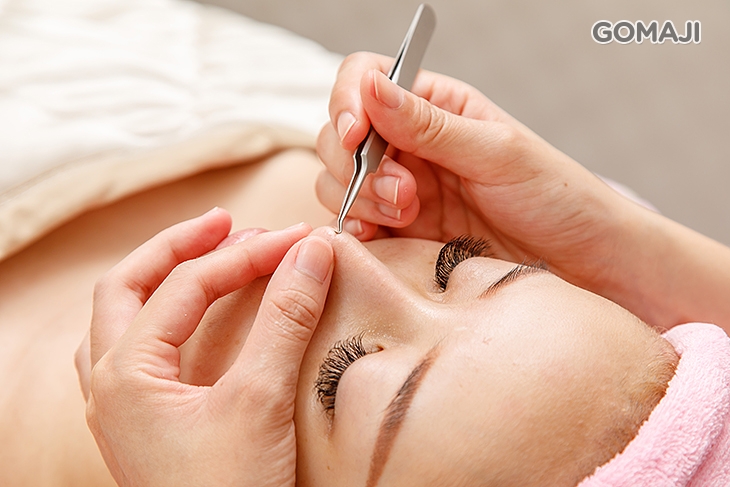 深層清潔痘痘粉刺