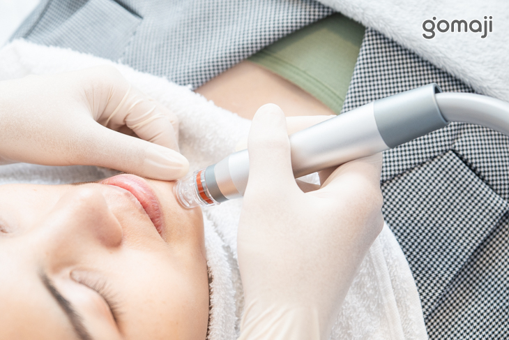 韓式水飛梭吸取毛孔粉刺髒污