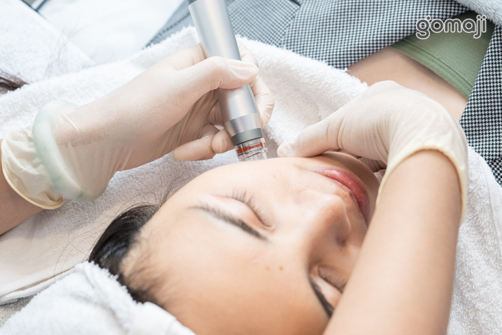 韓式水飛梭吸取毛孔粉刺髒污