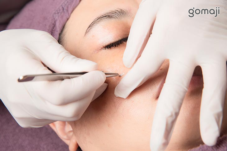 粉刺痘痘淨化調理