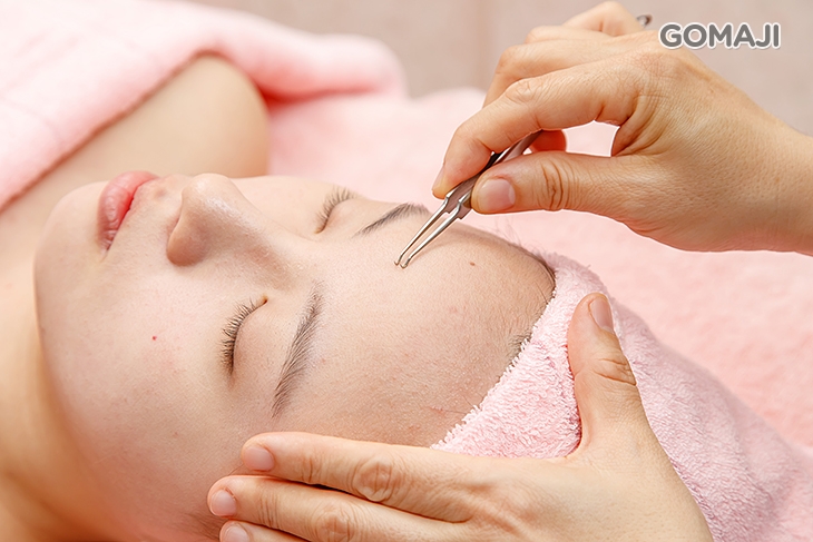 粉刺痘痘清潔(依個人膚況為主)