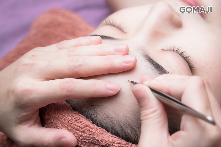  專業粉刺淨化清除