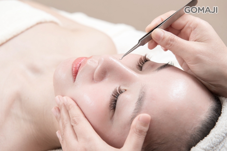 深層粉刺淨化調理