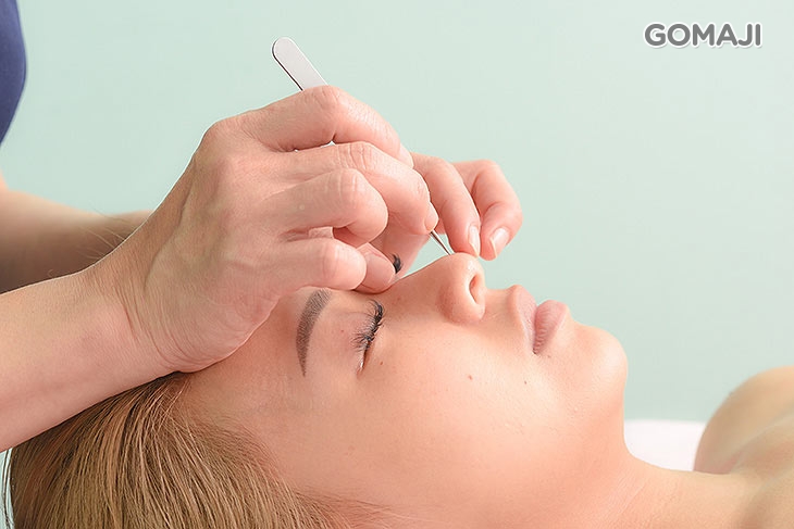 粉刺軟化 + 臉黑頭粉刺淨化清除(依個人膚況而定)