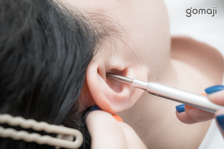 入耳專業內視鏡解說