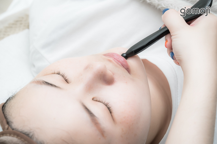 開始臉部撥彈緊緻小臉術操作