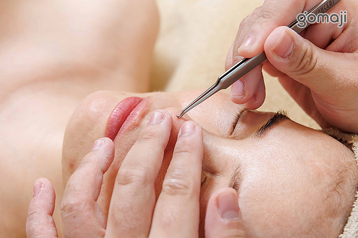 a.全臉手工深淺層粉刺淨化全程100分(純手技)