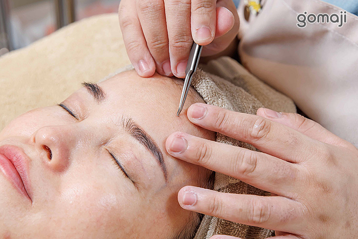 a.全臉手工深淺層粉刺淨化全程100分(純手技)