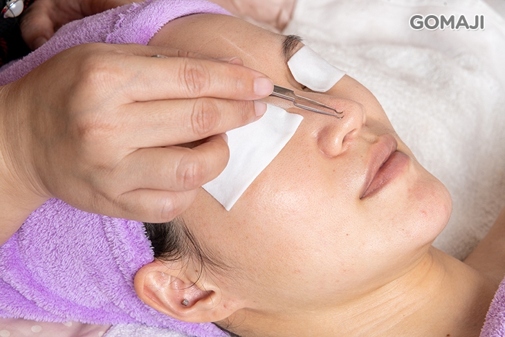 粉刺痘痘淨化調理