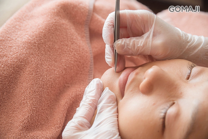 手工清粉刺痘痘