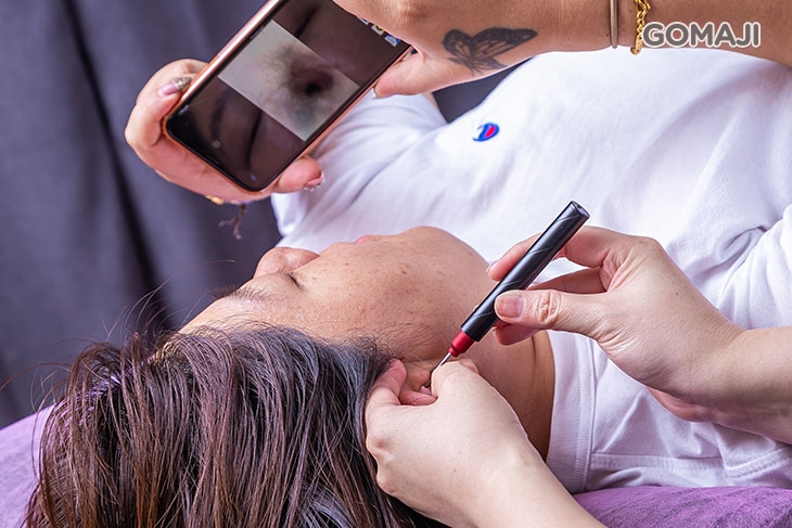 絲絲入耳專業內視鏡解說