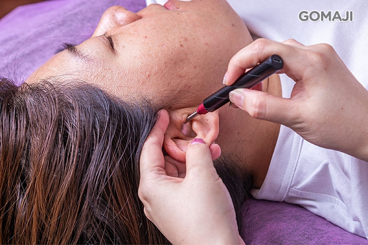 絲絲入耳專業內視鏡解說