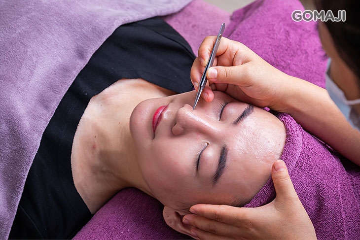 臉部抗痘粉刺清除護理