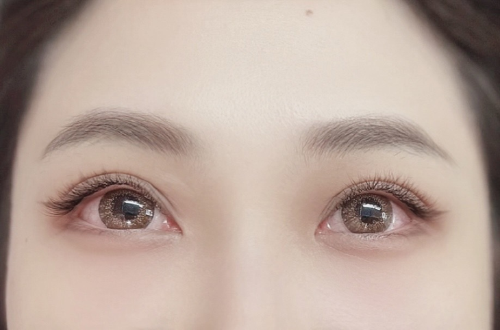 B方案根接根接到滿