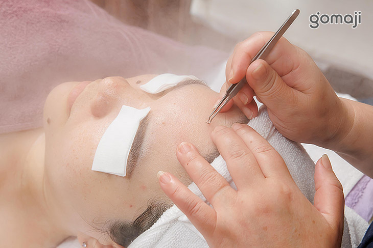 軟化毛孔粉刺深層調理