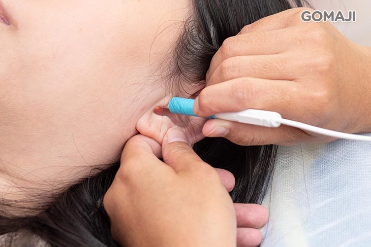 耳道內視鏡檢查