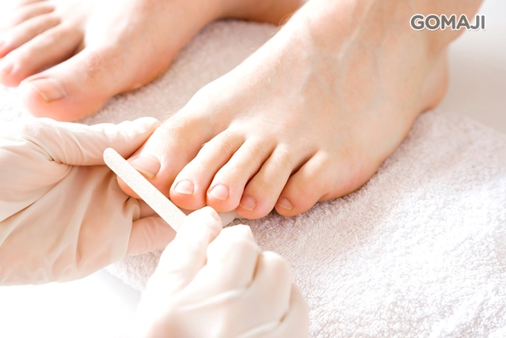 足部去繭去角質