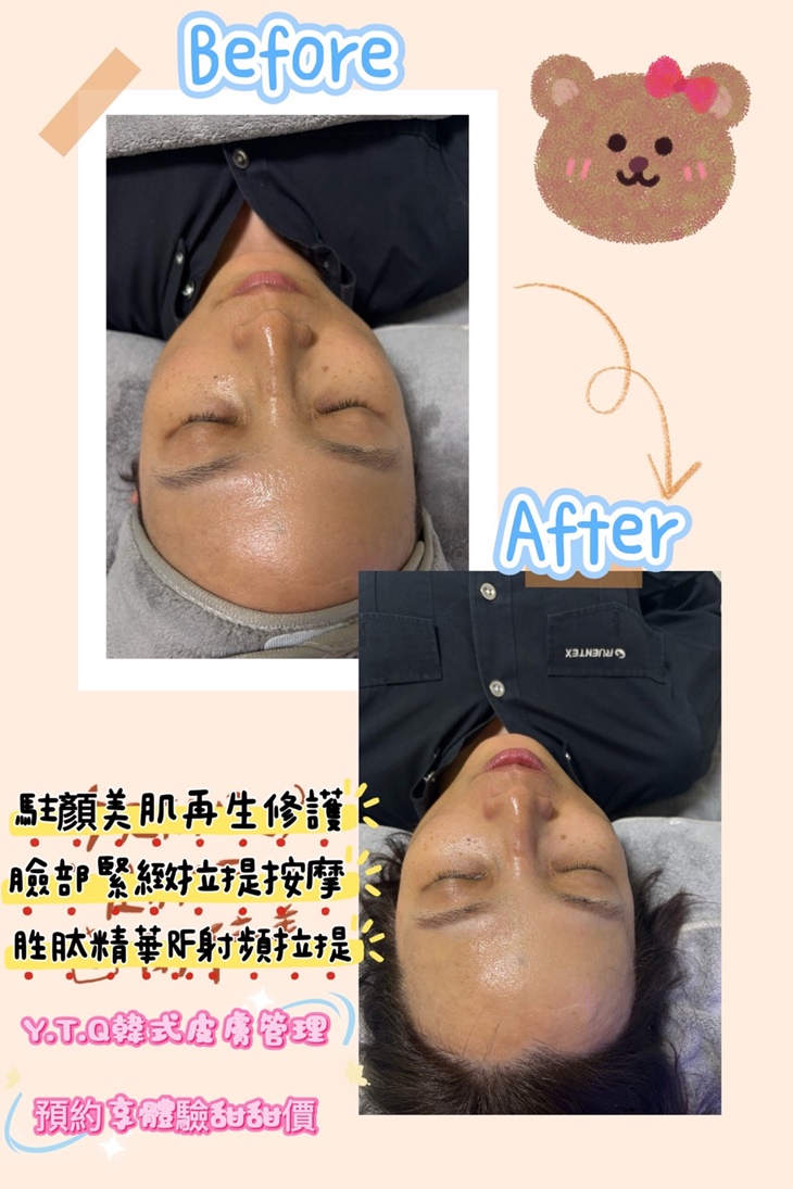 對抗老態臉！類醫美級多胜肽水光緊緻拉提護理