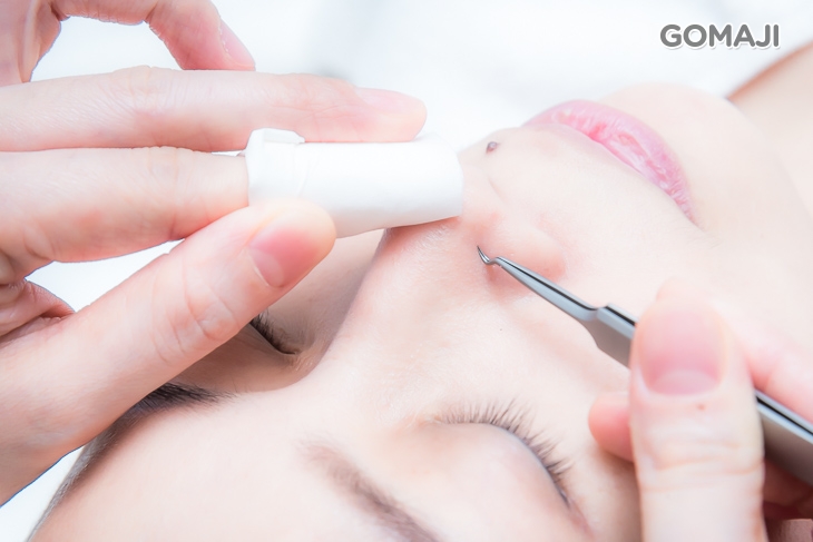 粉刺痘痘手工淨化調理