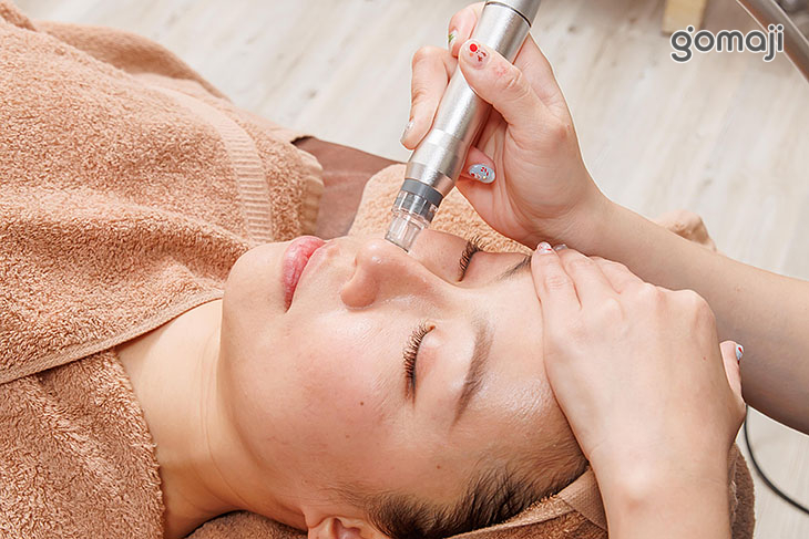 氣泡筆清除毛孔污垢