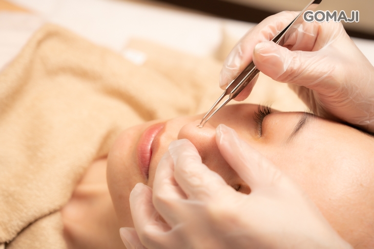 深層手工清潔粉刺