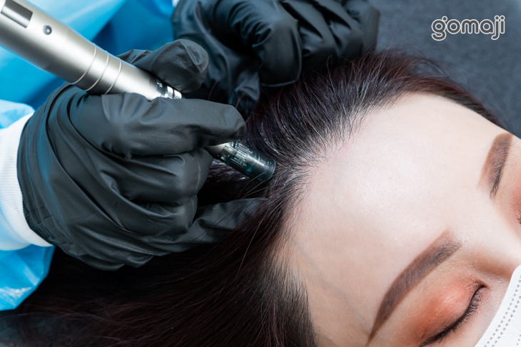 無菌奈米打通通道