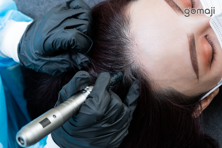 無菌奈米打通通道