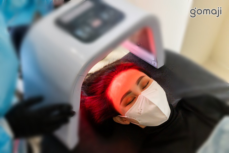 STC技術(復育毛囊新生毛髮)